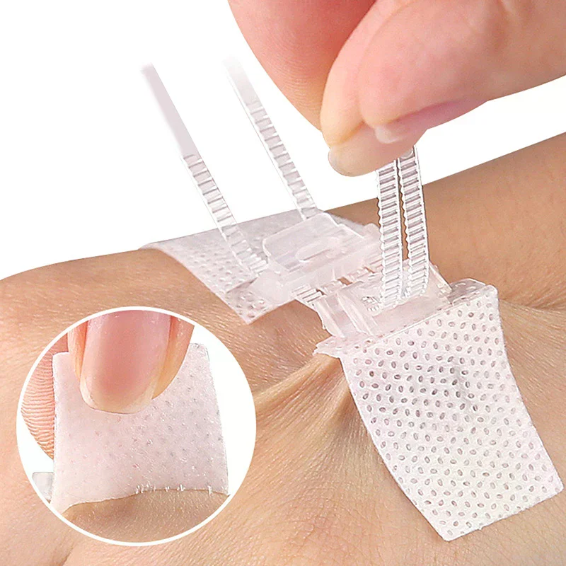 Zipper Band-aid Painless Wound Closure Patch Suture-free Wound Dressing Patches Zip Suture Reducer Band Aid Outdoor Portable
