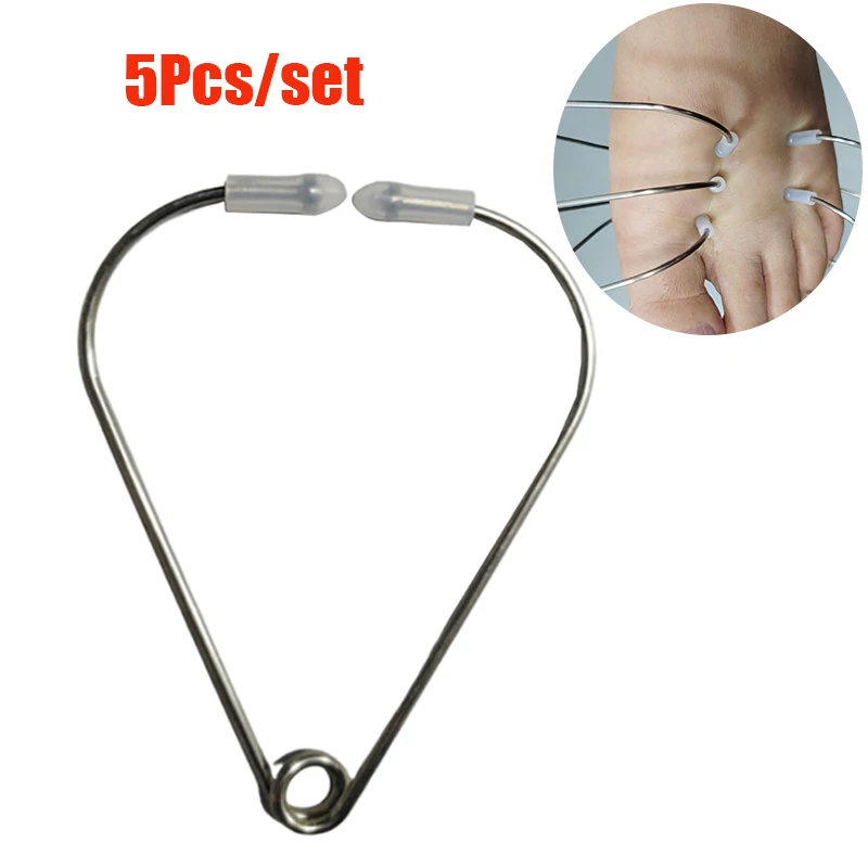 

Stainless Steel Acupoint Massager Ring 3-in-1 Hand Palm Foot Acupoint Clip Portable Pressure Stimulator Acupoint Massager Clip