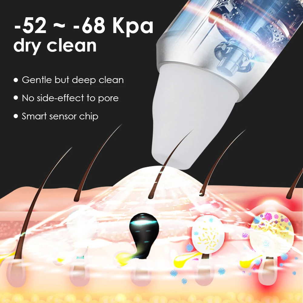 Synogal facial cleaner blackheads remover with vacuum electric suction machine blackhead remover face deep pore cleaner