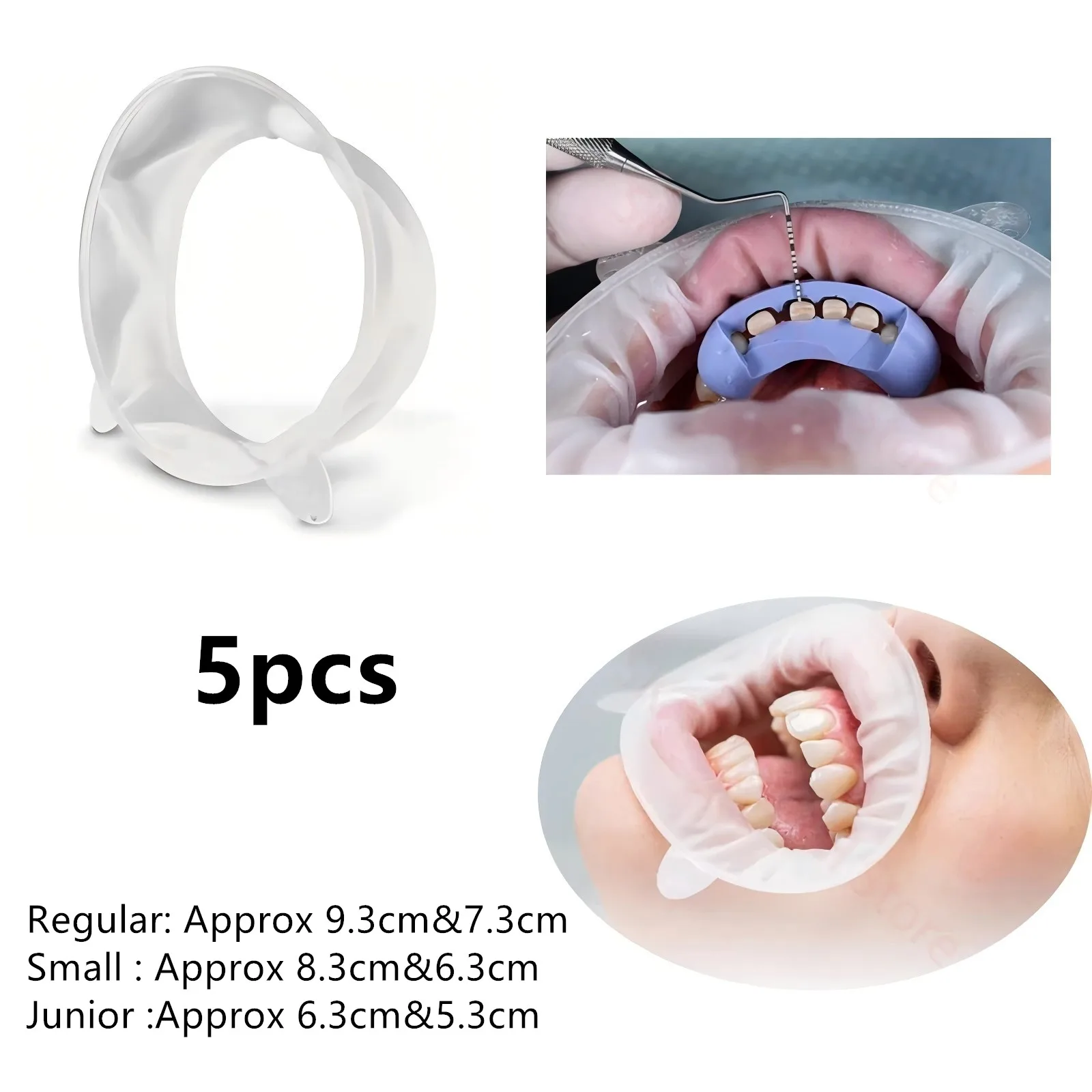 5pcs Dental Mouth Opener 3D Lip Cheek Retractor O Shape Rubber Expander for Oral Examination and Treatment Procedures