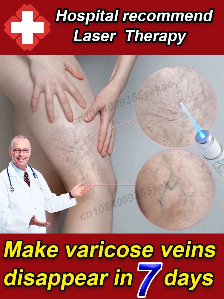 

Laser treatment for varicose veins, relieves pressure on the legs, improves blood circulation, varicose veins