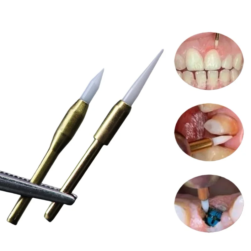 

1 шт., керамические высокоскоростные полировальные боры для обрезки мягких тканей 23/27 мм, хирургический инструмент для зубного имплантата, материалы для стоматологической клиники