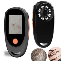 Dermatoscopio portátil analizador de piel microscopio Digital con pantalla IPS 1080P, lupa 500X para cuero cabelludo/pelo Trichomes faciales