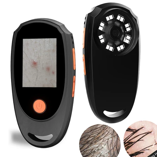 Dermatoscopio portátil analizador de piel microscopio Digital con pantalla IPS 1080P, lupa 500X para cuero cabelludo/pelo Trichomes faciales