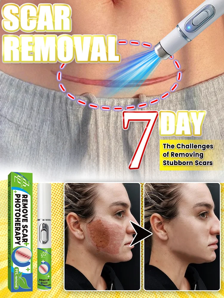 The latest laser equipment in 2025 will restore your skin to health!