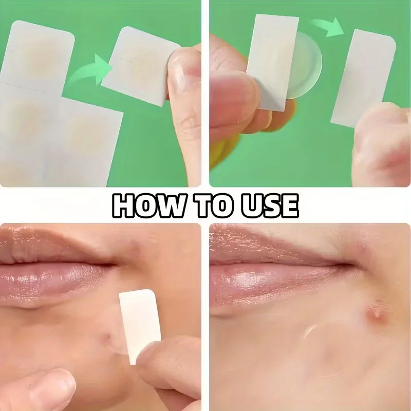 22 個のニキビ防止パッチ、ハイドロコロイドの目に見えないパッチ、マイルドな処方、より良いニキビ除去に役立ちます。