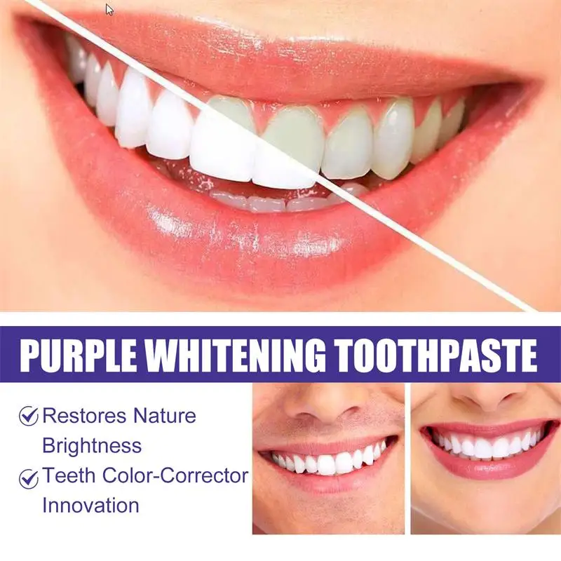 ยาสีฟันมูสฟอกสีฟัน 9D สีม่วง ข - Teeth Whitening Natural บทวิจารณ์และราคา