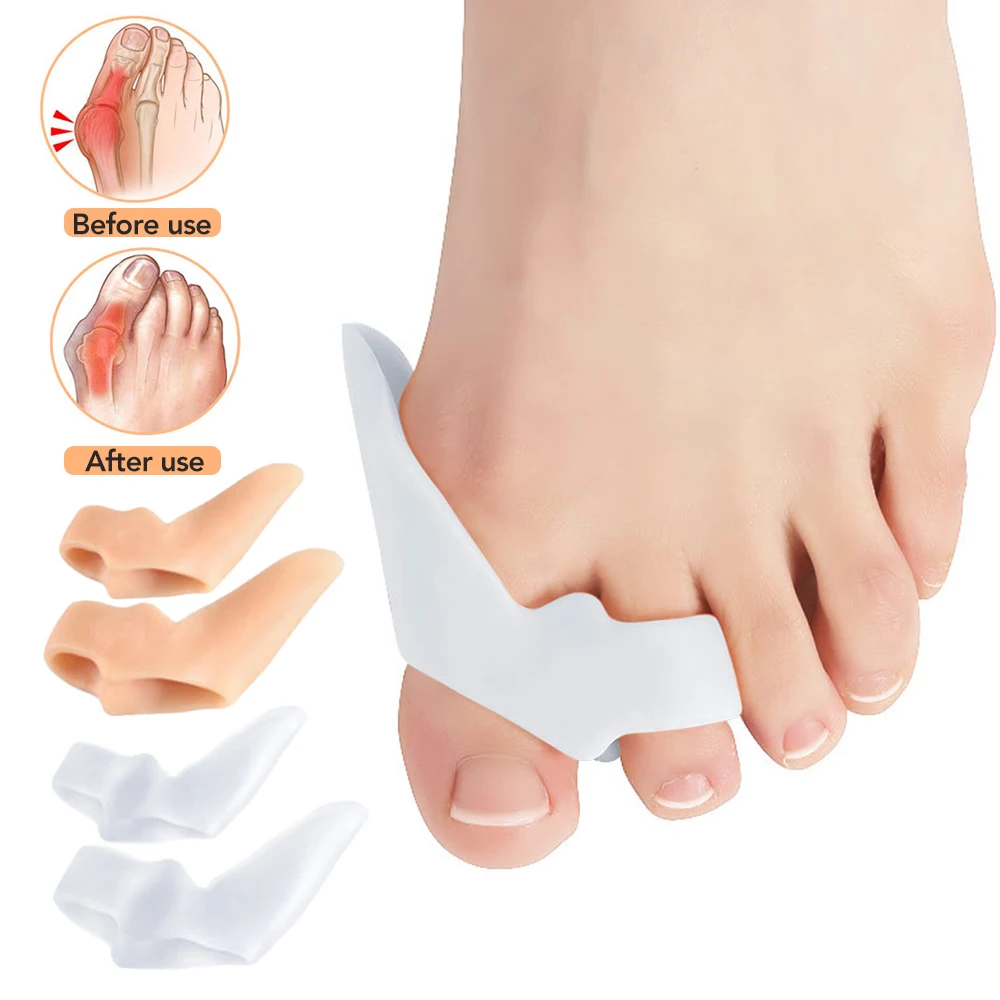 1Pair Stretchable Silicone Toe Separator, Big Thumb and Big Foot Bone Evaporated Toe Corrector, Can Be Used for Daily Commuting