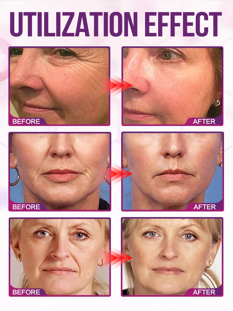 Solve facial aging problems