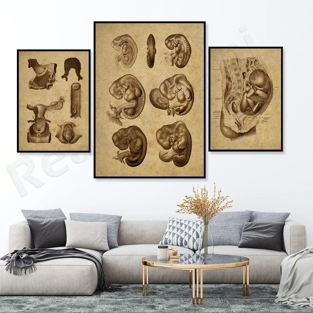 （Unframe 3PCS）-vintage Posters Fetus in Womb Antique Illustration Embryo  Pregnancy Medical Print Midwife Art Female Anatomy