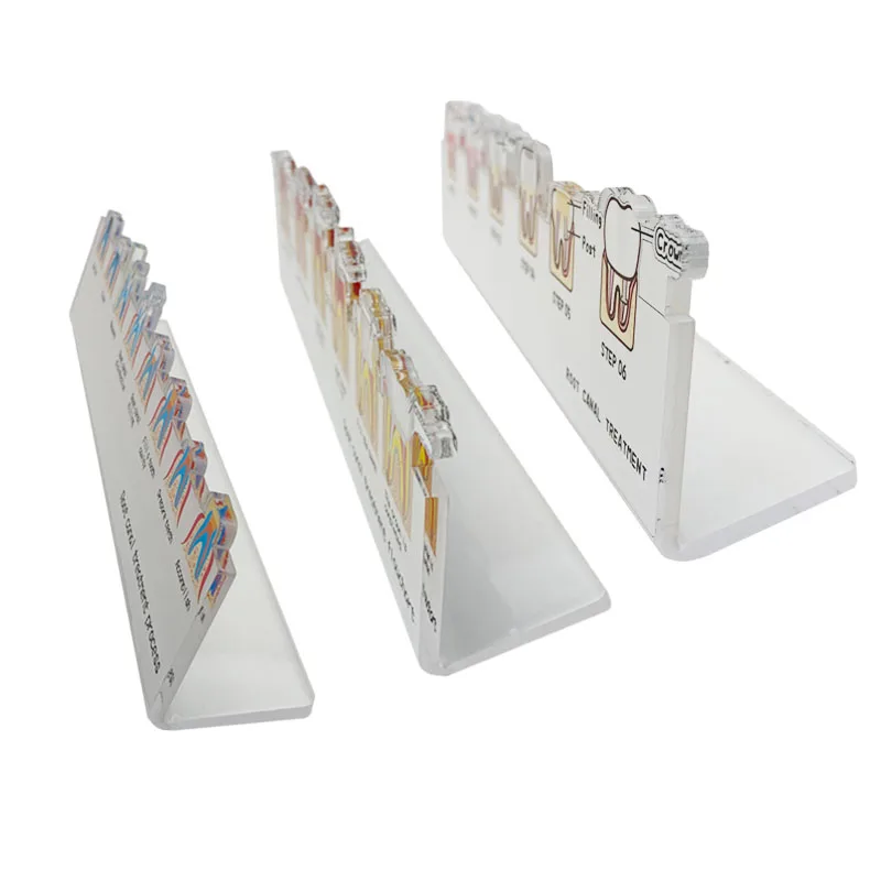 Dental Root Canal Treatment Flowchart Stand Endodontic Process Guide Dental Lab Study Teaching Demonstration Model Dentist Gift