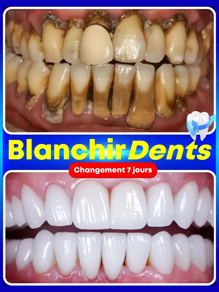 2026 The Latest Whitening Toot - Teeth Whitening Effective recension och pris