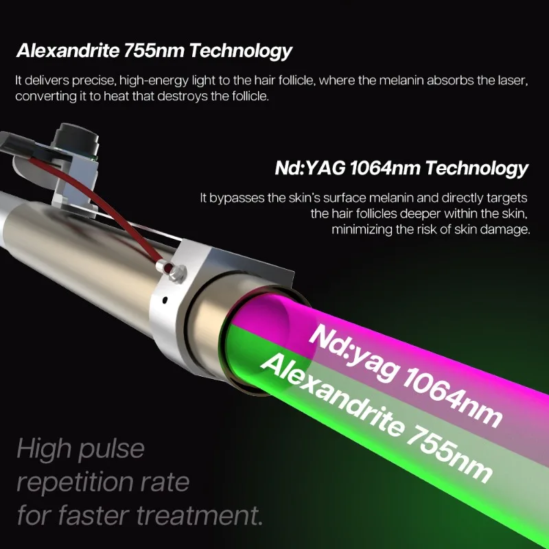 เครื่องกำจัดขนด้วยเลเซอร์ Nd Y - Alexandrite Laser Hair Removal Machine บทวิจารณ์และราคา