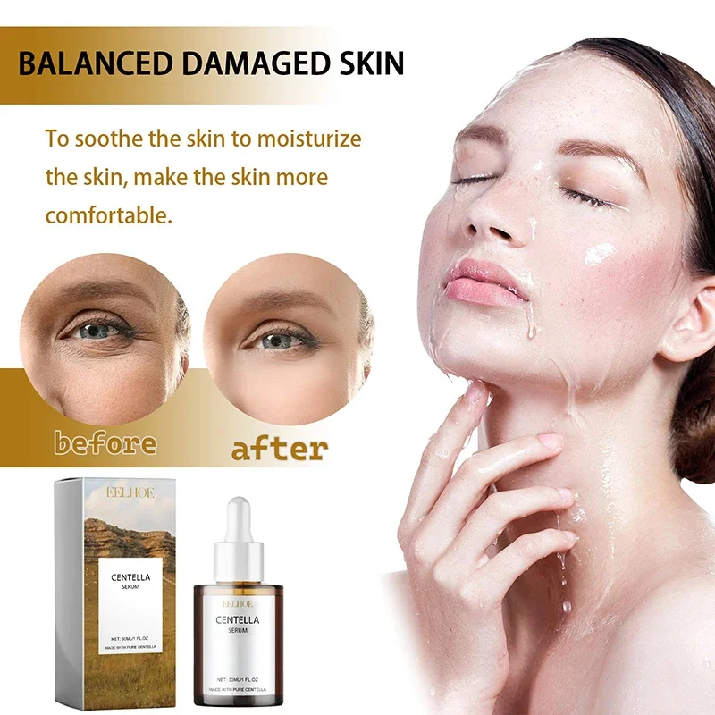 Centella Asiatica suero Facial nutre la piel seca suavizante rejuvenecimiento brillo de la piel crema blanqueadora hidratante Facial coreano