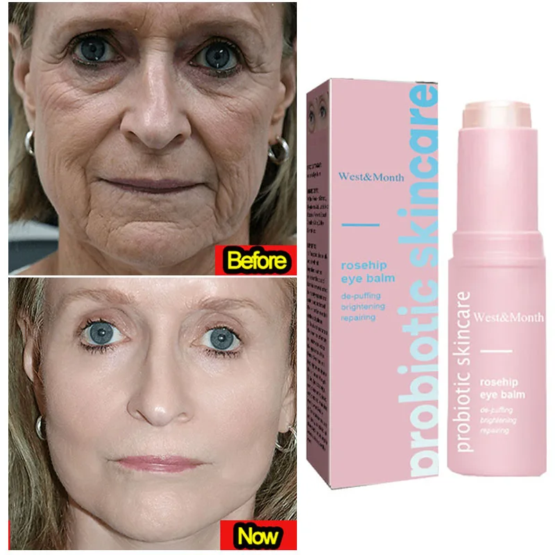 Women Extra Renewing Rosehip Eye Cream For Face Lifting Moisturizing Balm Stick Anti-Puffiness Remove Dark Circle Eye Care 2024.