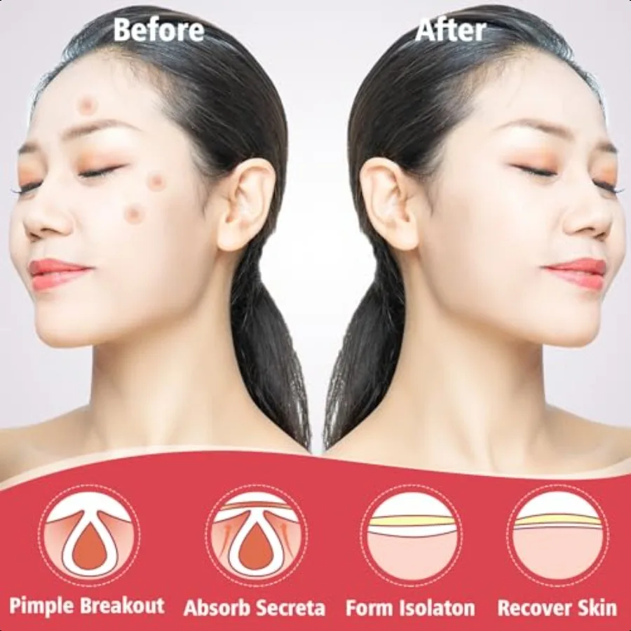 450 Plastrów na Pryszcze na Twarz Hydrokoloidowe Plasterki na Trądzik na Pryszcze Mighty Patch Niewidoczne Plasterki na Pryszcze na Twarz 4 Rozmiary