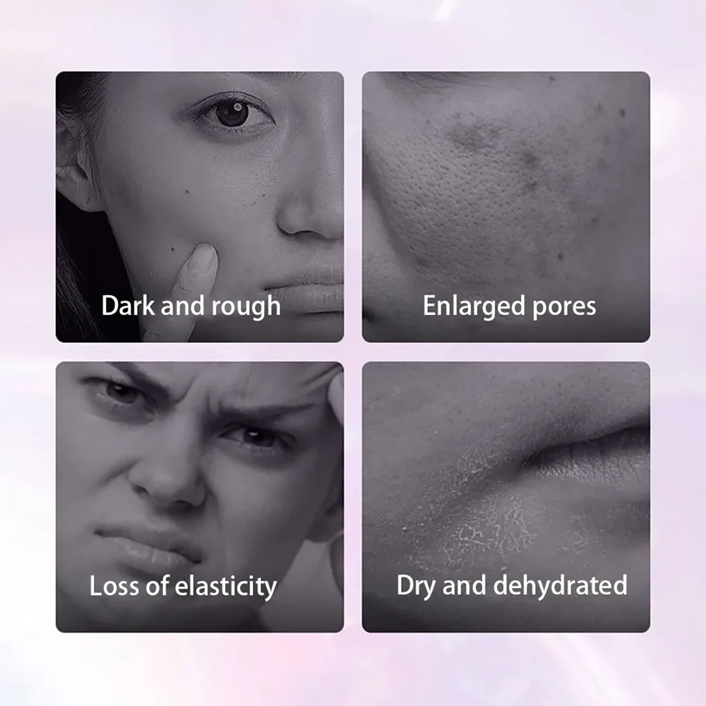 الفاوانيا الحمراء الجينسنغ مستخلص نباتي اختراق العضلات مجموعات العناية بالبشرة تقليص المسام سطع تحسين خشونة تعزيز مرونة الجلد