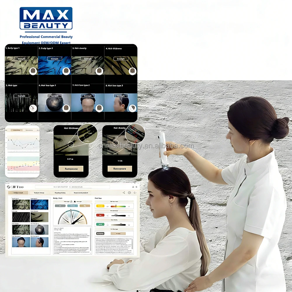 Made In Korea Handheld Multi-languages Full HD Hair And Scalp Analyzer Machine Hair Analysis Machine