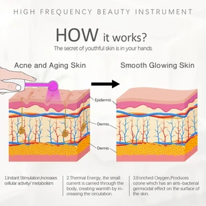 Hochfrequenz -Gesichtsanbieter -Zauberstab -Gerät, Behandlung mit Akne -Werkzeug, Haarpflege, professionelles Kit mit Geschenkbox, 4pcs 8 Hauptverkaufsweg Anti -Aging - №5