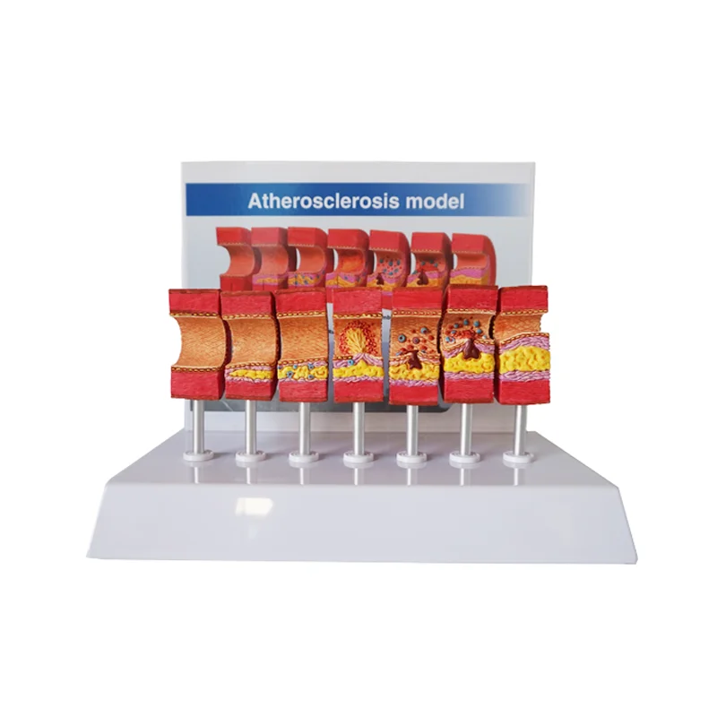 

Arterial Vessel Atherosclerosis Model Middle-Aged And Elderly Blood Vessel Structure Model