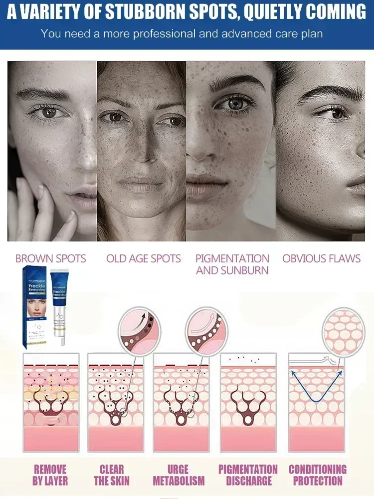 Whitening Anti-Freckle Cream Brighten Skin Tone Remove Freckles Lighten Spots Chloasma Brighten Moisturize Face Skin Care