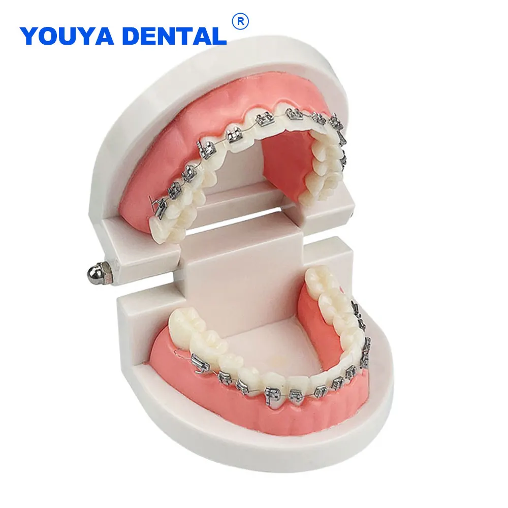 

Full Metal Bracket Orthodontic Teeth Model With Ortho Wire Buccal Tube Ligature Ties Dental Treatment Model Dentist Tools Lab