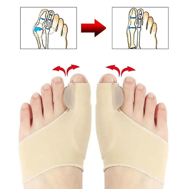 1 Paar Bunion Corrector, Teen Separator Voor Grote Teen Ontspannen, Verspreid En Stretch Voor Hallux Valgus & Bunion Ondersteuning Protector