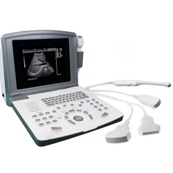 10 Inch LED Black and White Laptop Portable B Human Ultrasound Scanner Echo b-ultrasound Machine