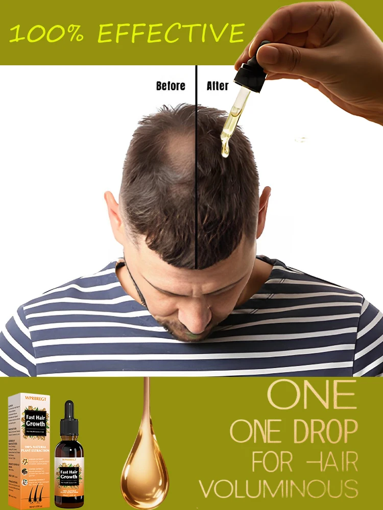 

Usᴇᴅ ᴛᴏ ᴘʀᴇᴠᴇɴᴛ ʜᴀɪʀ ʟᴏss, ɪɴᴄʀᴇᴀsᴇ ʜᴀɪʀ ᴅᴇɴsɪᴛʏ, ᴀɴᴅ ᴘʀᴏᴍᴏᴛᴇ ᴍᴀʟᴇ ᴀɴᴅ ғᴇᴍᴀʟᴇ ʜᴀɪʀ ɢʀᴏᴡᴛʜ