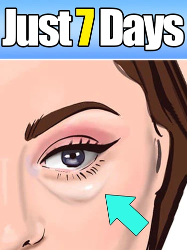 Generación-2, envío gratis, ayuda a las personas que alrededor de los ojos, soluciona sus problemas, gran oferta