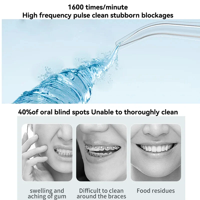 Thumbnail 3 - #18 Compare Dental Water Jets Before You Buy