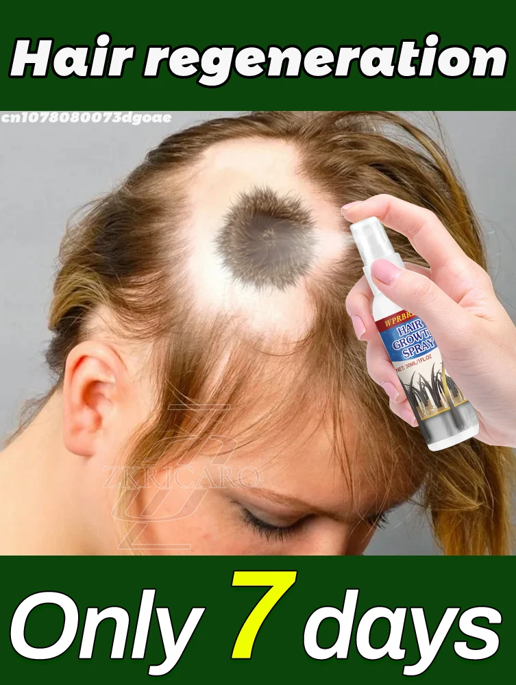 

[Специальное предложение: 3 бутылки] натуральные волосы Plüh | Рост Spr Fisk быстро активирует корни волос и утолщает линию волос в течение 7 дней