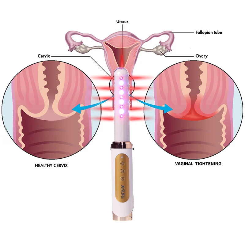 

Yoni Sticker For Vaginal Tightening And Kegel Exercises Cervical Erosion Light Therapy For Vaginal Dryness