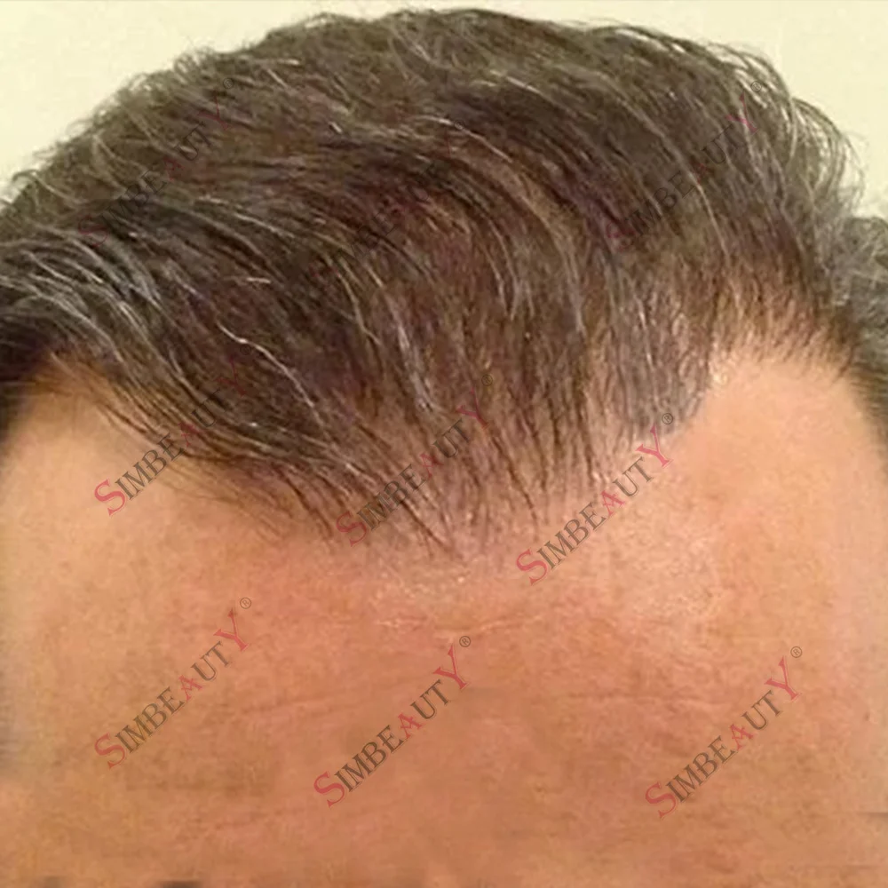 

Светлый тон, 80% плотности, натуральный, 0.02 мм, ультратонкая основа для кожи, 610 # Мужской парик-система протезирования волос из реми-волокна: коричнево-серый, светлый, черный, ультратонкий