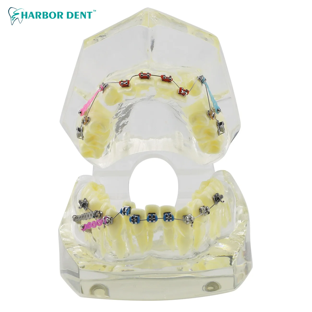 Dental Implant Disease Teeth Model with Restoration Bridge Tooth Dentist Dental Disease Teaching Study Dental Education Model