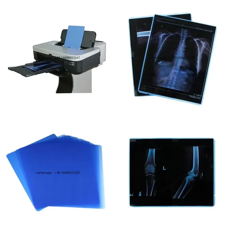 ZT-MP-I1 Inkjet X Ray Dry X-ray