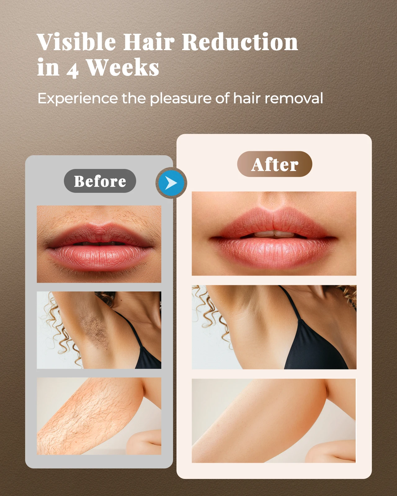 Máquina IPL 2026 para Rejuvene - Hair Care Homemade avaliação e preço
