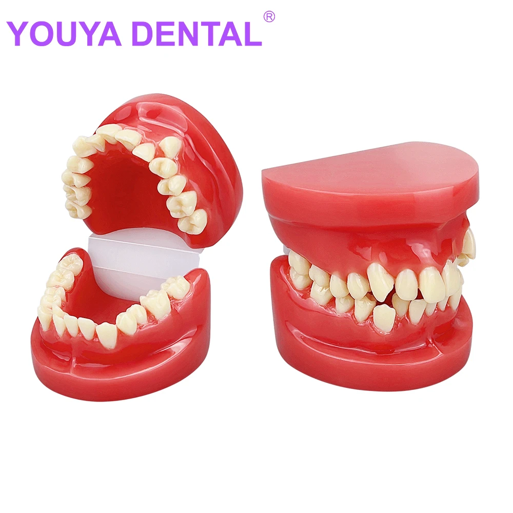 

Dental Teeth Model Dental Teeth Malocclusion Model for Dentist Students Practice Teaching Training Communication Model Dentistry