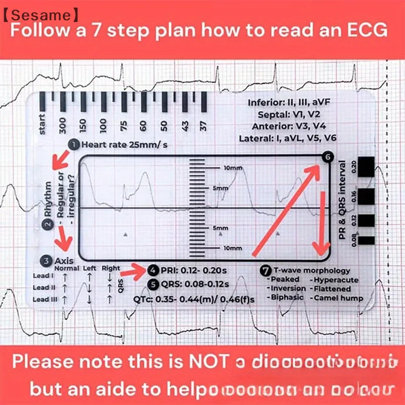 7 Step Ruler, Ruler Plastic Ruler Measuring Tool, 7 Step Ruler For Interpretation, Transparent EKG Calipers Measuring Tool