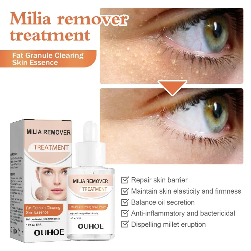 Milia Fleckent ferner straffen des Serum Akne Reparatur Fett Granulat Milia Spot Augen taschen dunkler Kreis Anti-Aging feuchtigkeit spendende Augen pflege 30ml