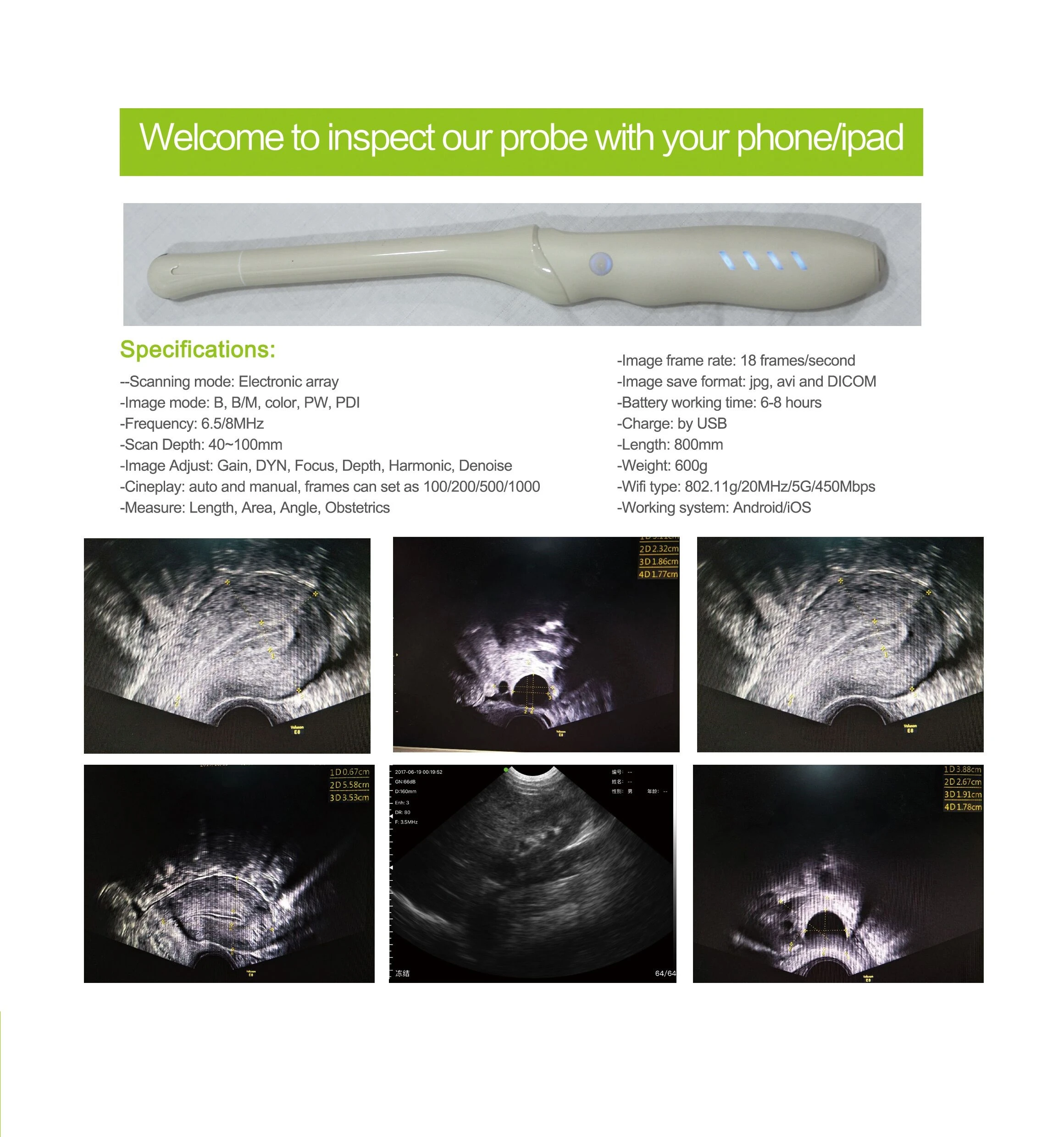 SY-AVL_vet Wireless Veterinary Ultrasound Equipment Transrectal Ultrasound Portable Veterinary Linear