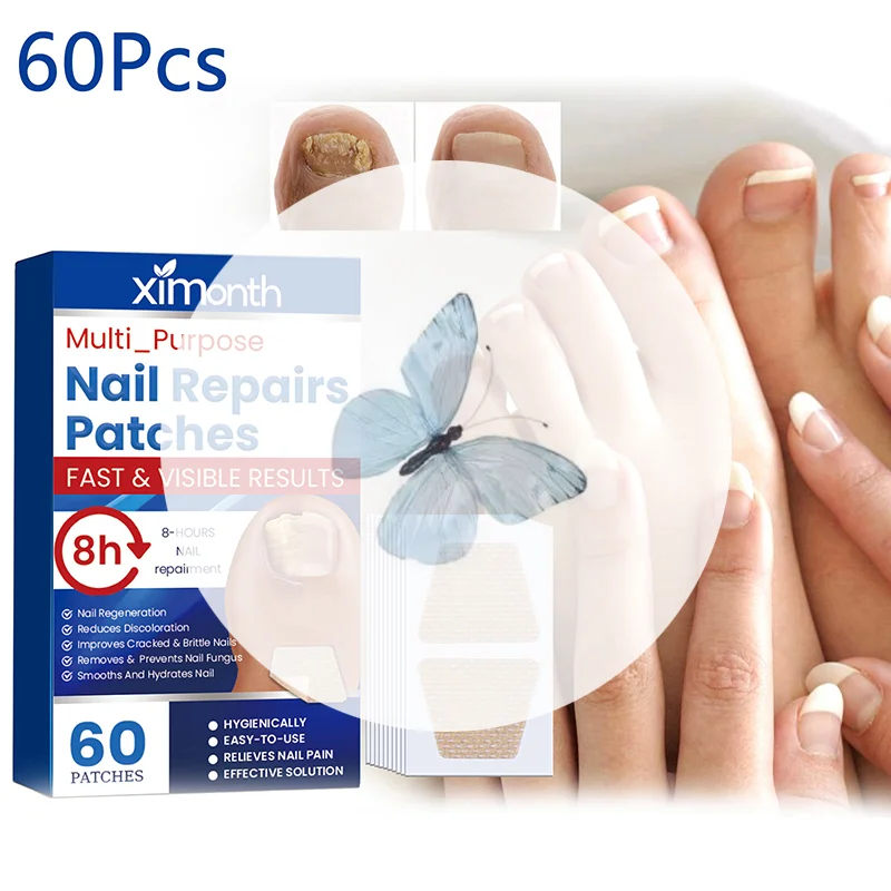 60Pcs Toenail Fungus Patch Sticky Nail Repair Patch Nail Ingrown Correction Sticker Toenail Care Paronychia Nail Treatment Patch