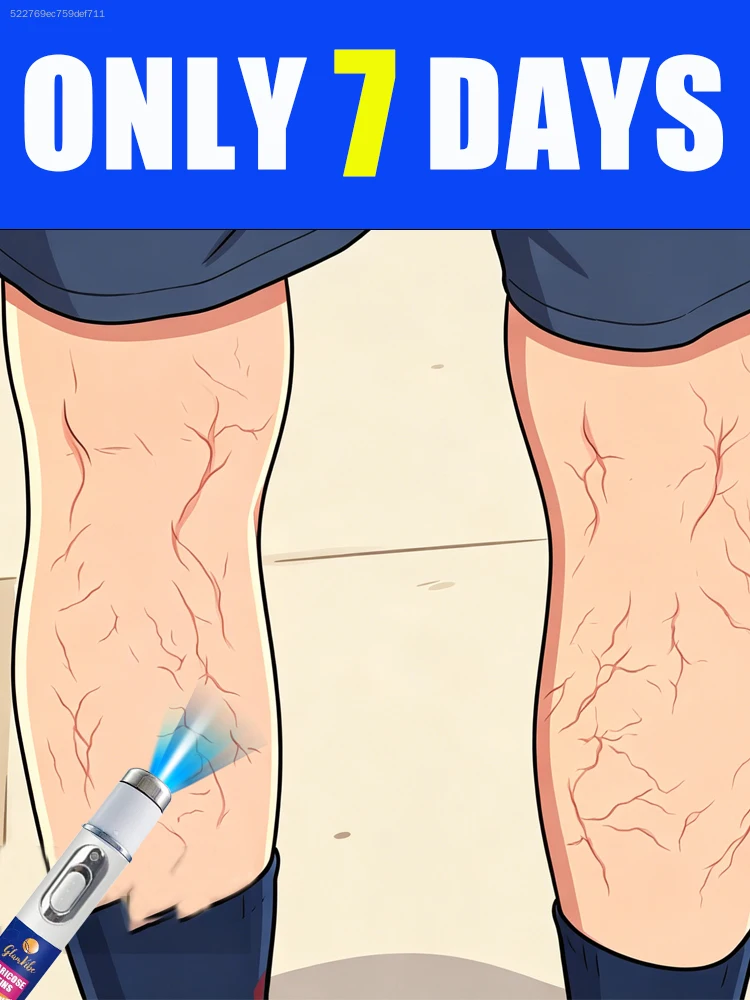 

The sooner you notice blue veins appearing on your legs, the better.