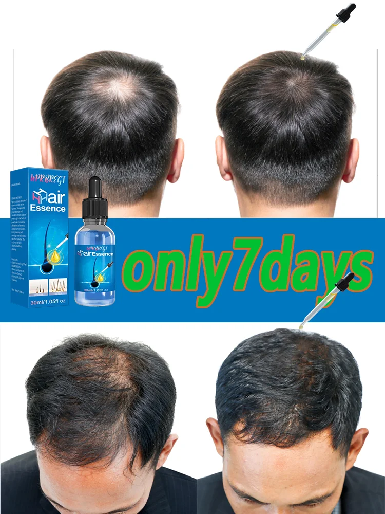 

Новейшее эфирное масло для роста волос 2025 года, эффективный рост волос