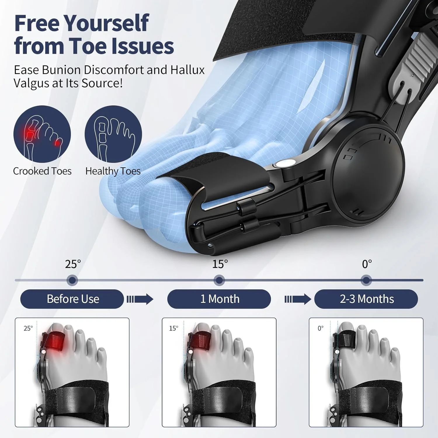 Hallux Valgus Corrector - Adjustable Bunion Splint & Toe Separator, 24H Wear Unisex Orthopedic Foot Alignment Support‌