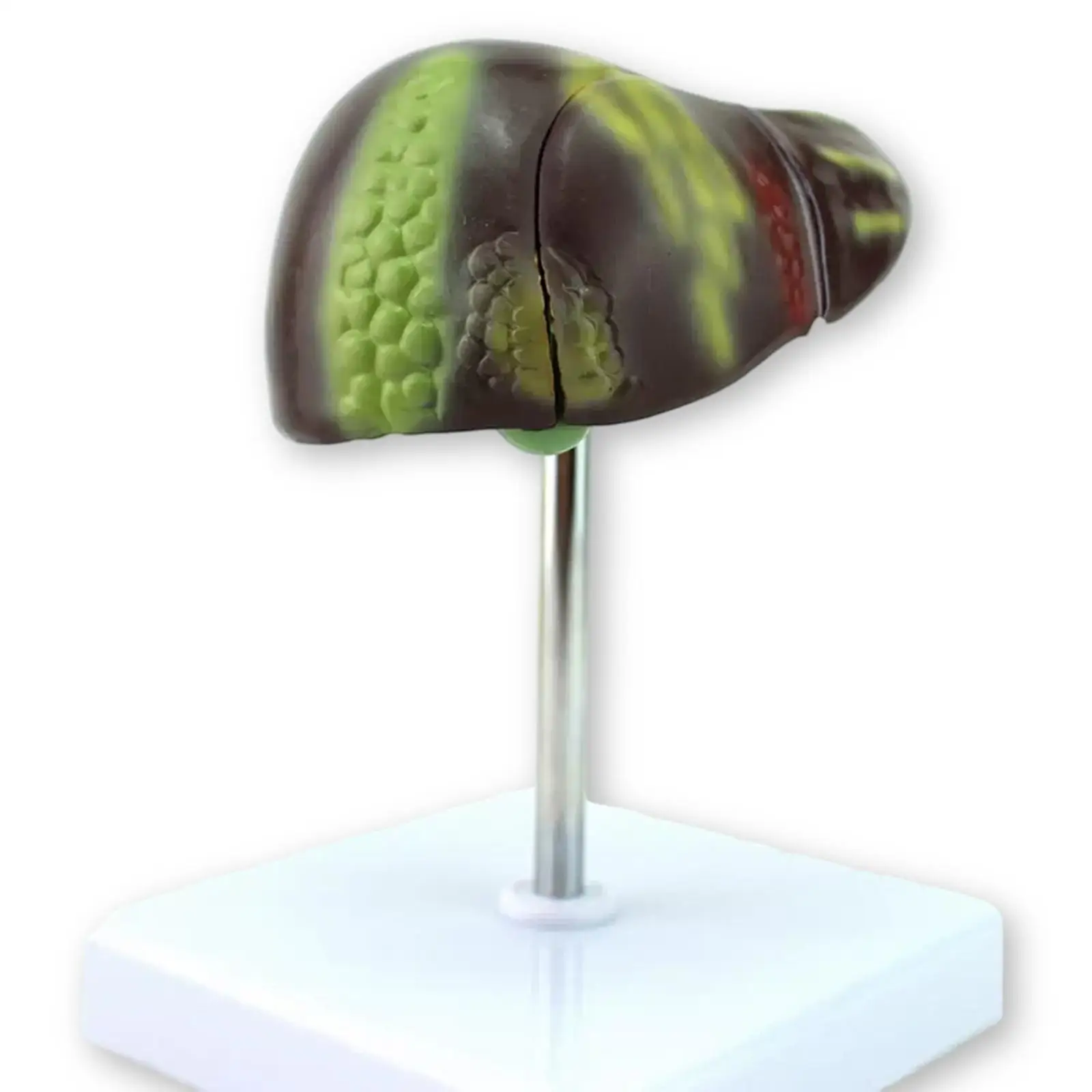 PVC Human Pathological Fatty Liver Cirrhosis Hepatitis Model Medical Teaching Models