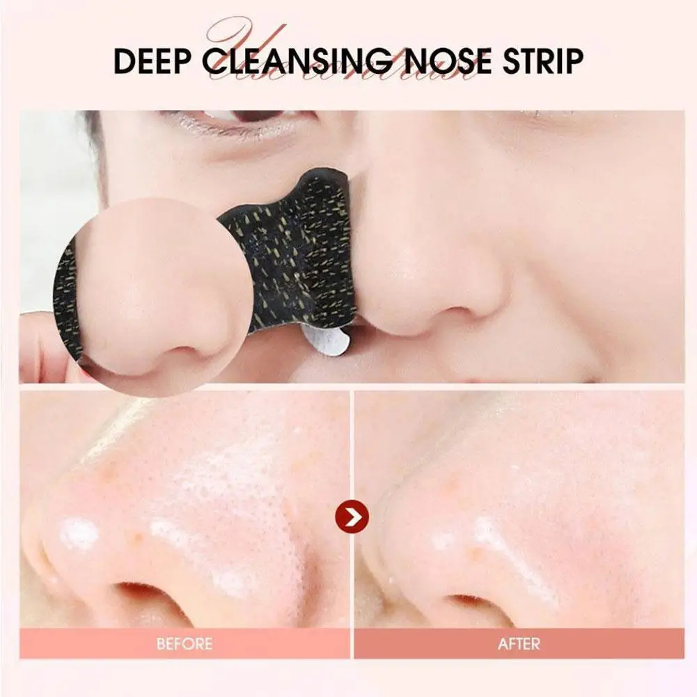 Limpeza profunda cravo removedor máscara, cuidados com a pele, preto Poro tiras, tratamento Poro, acne pontos, nariz psiquiatra, limpo, S1R3