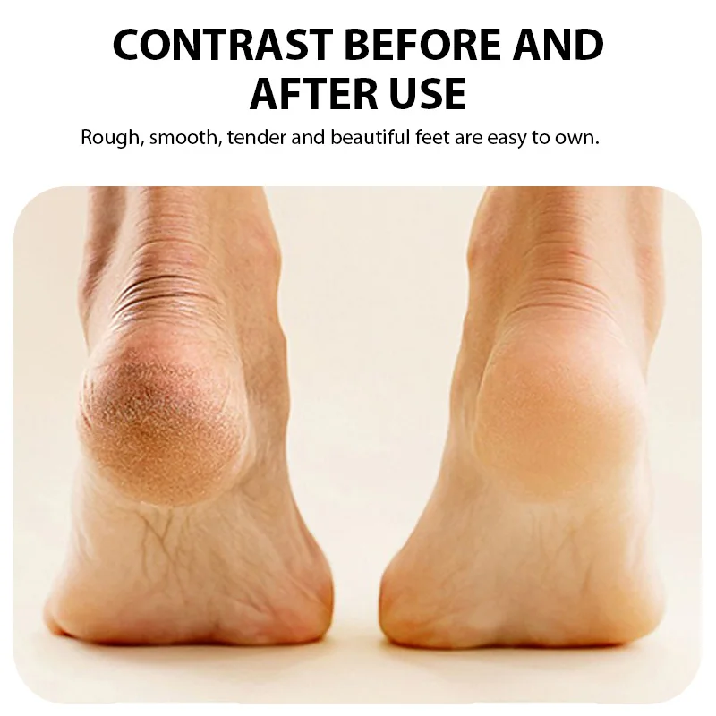 Broyeur électrique pour les pieds, Rechargeable, dissolvant de peau morte, épurateur de pieds, callosités, pédicure, lime sèche et craquelée, réparation de soins des pieds