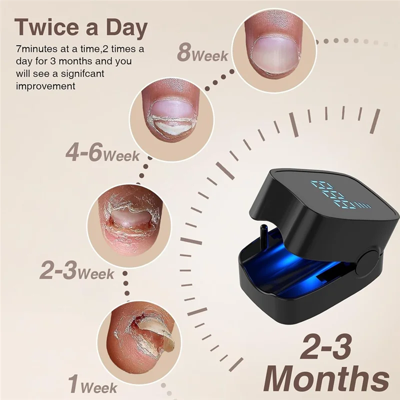 ABKR-dispositif de traitement des champignons des ongles 905Nm infrarouge et 470Nm lumière Laser bleue LED-thérapie d'onychomycose pour usage domestique-noir