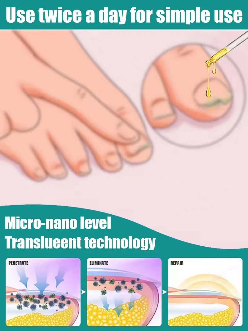 يغير الحياة وقلم ليزر للأظافر بلون الشمبانيا s sṁs